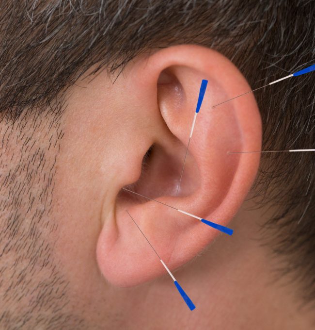 auriculotherapie-(photo-dr-shutterstock)-1509038509